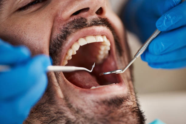 Best Emergency Dental Extractions in Pimlico, SC